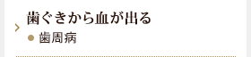 歯ぐきから血が出る　歯周病